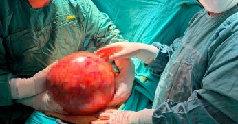 1,5 yıl ertelediği ameliyatta doktorlar gözlerine inanamadı!