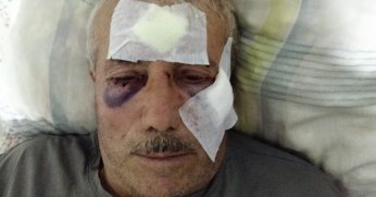 İnek bahçeden geçti: 68 yaşındaki komşusunu muştayla darp etti! 