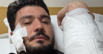 Muşta ile darbettiği iddia edilen taraf: 'Müvekkilim muşta kullanmadı'