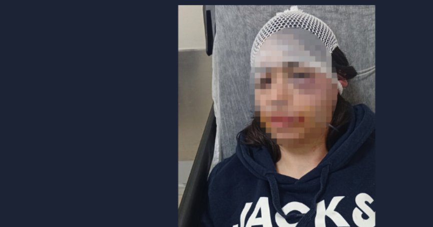 Ayrılığı hazmedemedi, Genç kadını acımasızca dövdü