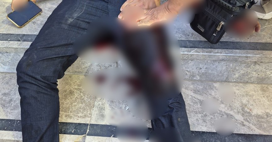 Kovaladığı Şahsı Bacağından Vurup Kaçtı!