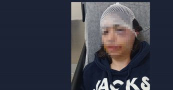 Ayrılığı hazmedemedi, Genç kadını acımasızca dövdü