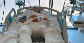  Otomobilin çarptıktan sonra üzerinden geçtiği genç kız ağır yaralandı